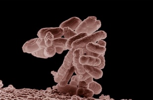 A bacteria estudada, a Escherichia coli